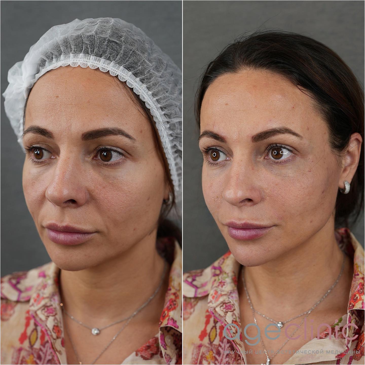 Клиника эстетической медицины и косметологии в Москве | Age Clinic